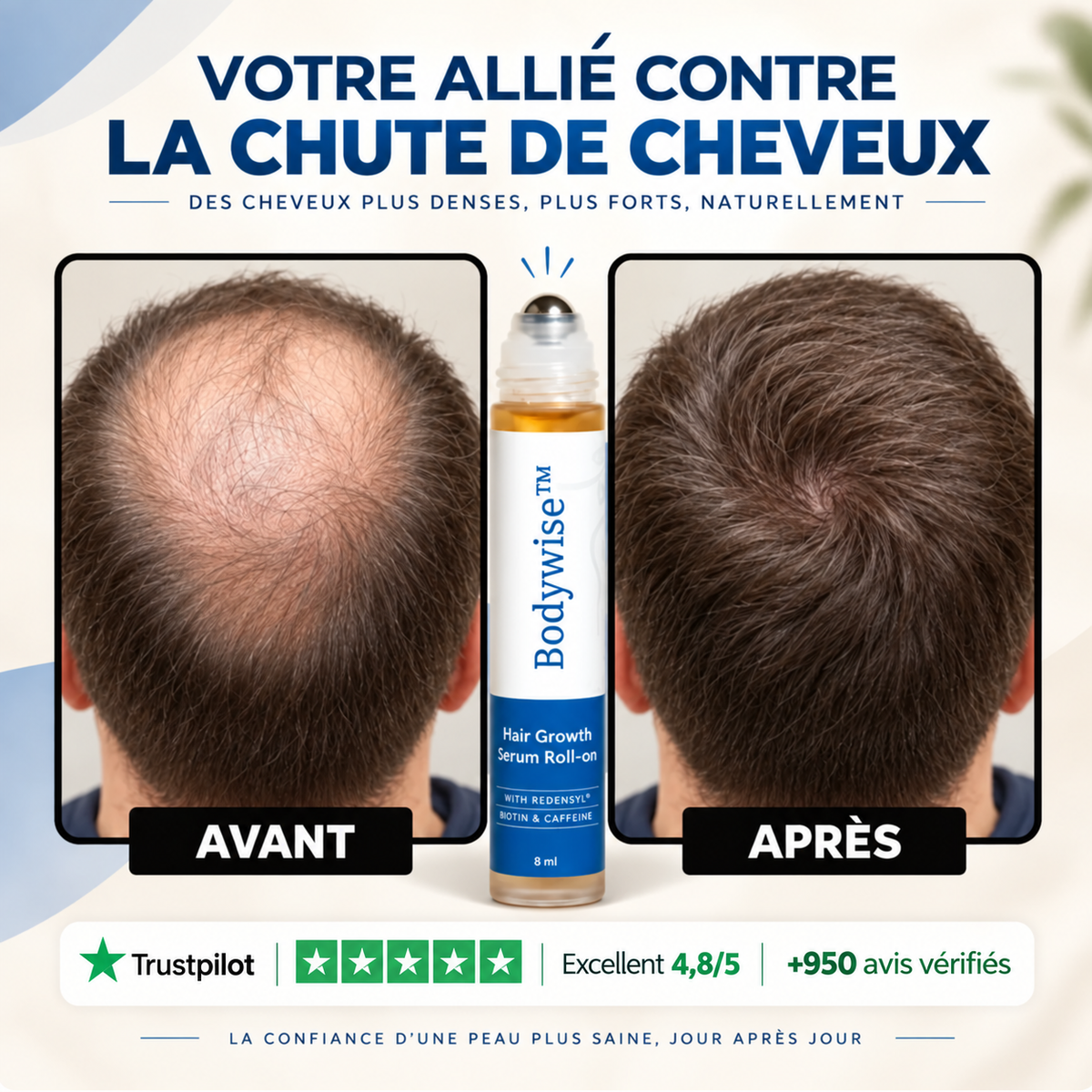 <b>BodyWise™ Sérum pour la croissance des cheveux</b>