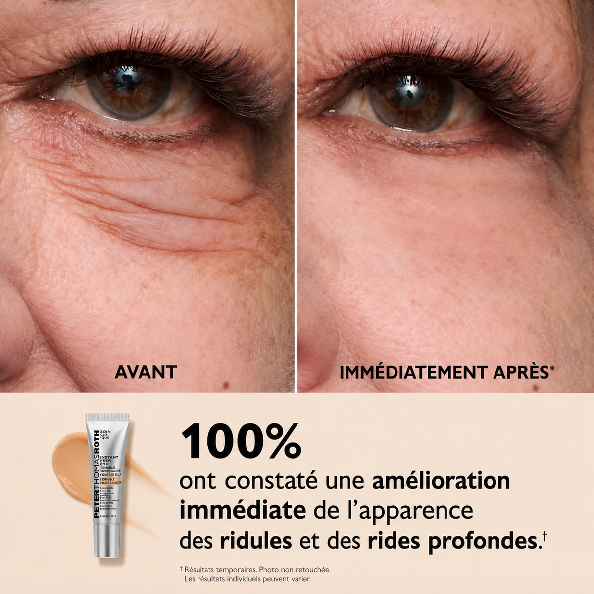 Peter Thomas Roth - Le Regard Lift